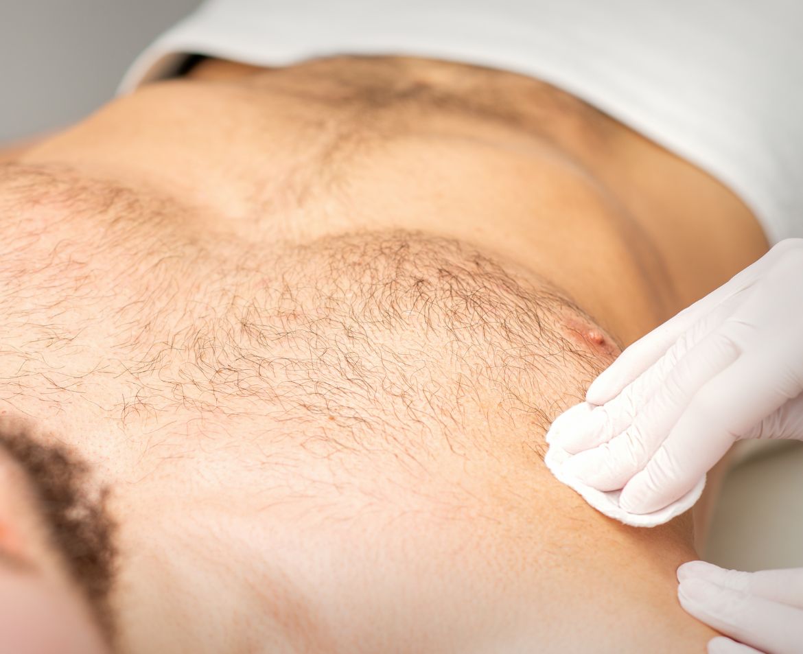 TRIỆT LÔNG NAM HOT NGHỆ AN