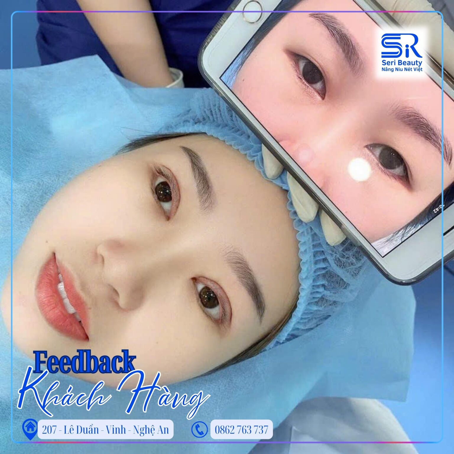 Cắt mí tại Seri Beauty